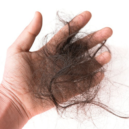 Excessive hair shedding in hand, prevented by Vividreamore Velo Essential curly hair dryer with high air volume airflow and ionic comb attachment.